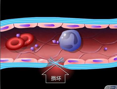 三維醫學動畫